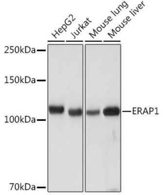 Western Blot: Aminopeptidase PILS/ARTS1 Antibody (6V8C0) [NBP3-16626]