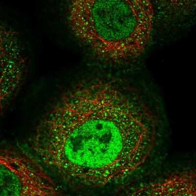 Immunocytochemistry/ Immunofluorescence: Aminopeptidase PILS/ARTS1 Antibody [NBP2-59005]