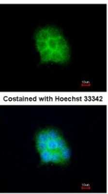 Immunocytochemistry/ Immunofluorescence: Amisyn Antibody [NBP2-15376]