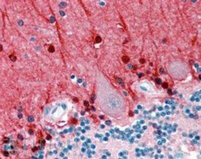 Immunohistochemistry-Paraffin: Amphiphysin/AMPH Antibody [NB100-40788]