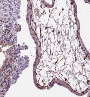 Immunohistochemistry-Paraffin: Amphiregulin Antibody [NBP1-87071]