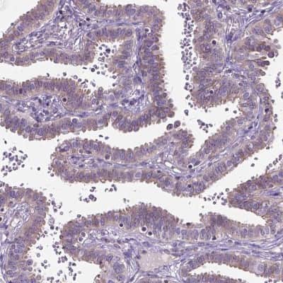 Immunohistochemistry-Paraffin: Amphiregulin Antibody [NBP1-87071]