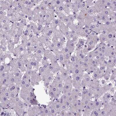 Immunohistochemistry-Paraffin: Amphiregulin Antibody [NBP1-87071]