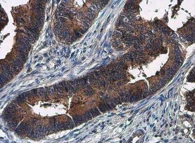 Immunohistochemistry-Paraffin: Amphiregulin Antibody [NBP2-15379]