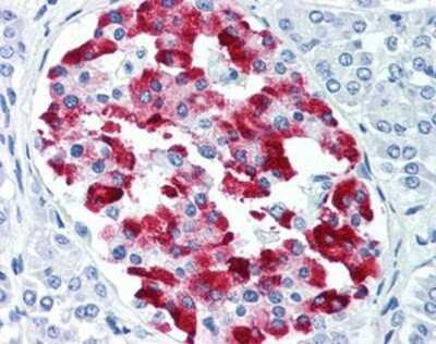 Immunohistochemistry-Paraffin: Amylin Antibody (R10/99) [NB600-713]