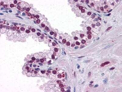 Immunohistochemistry-Paraffin: Androgen R/NR3C4 Antibody (2H8) - Azide and BSA Free [NBP2-80576]