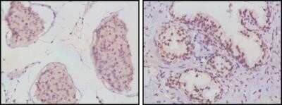 Immunohistochemistry-Paraffin: Androgen R/NR3C4 Antibody (2H8) - Azide and BSA Free [NBP2-80576]