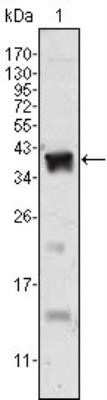 Western Blot: Androgen R/NR3C4 Antibody (2H8)Azide and BSA Free [NBP2-80576]