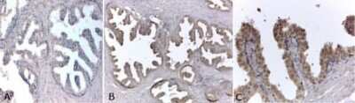 Immunohistochemistry-Paraffin: Androgen R/NR3C4 Antibody (AN1-15) - BSA Free [NB300-615]