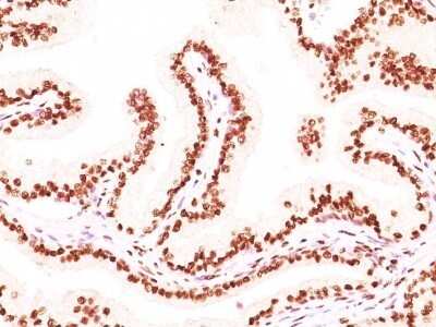 Immunohistochemistry-Paraffin: Androgen R/NR3C4 Antibody (AR441 + DHTR/882) - Azide and BSA Free [NBP2-47857]