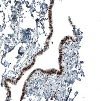 Immunohistochemistry-Paraffin: Androgen R/NR3C4 Antibody (CL9255) [NBP2-88922]