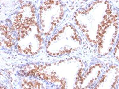 Immunohistochemistry-Paraffin: Androgen R/NR3C4 Antibody (DHTR/882) - Azide and BSA Free [NBP2-47856]