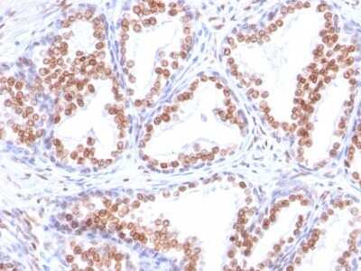 Immunohistochemistry-Paraffin: Androgen R/NR3C4 Antibody (DHTR/882) [NBP2-44788]