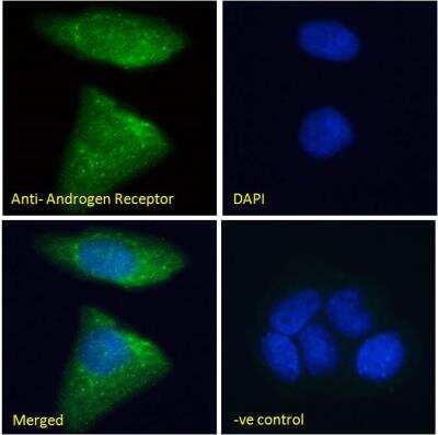Immunocytochemistry/ Immunofluorescence: Androgen R/NR3C4 Antibody [NB100-1446]