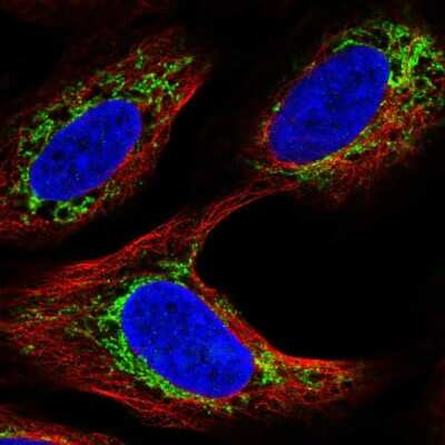 Immunocytochemistry/ Immunofluorescence: Androgen R/NR3C4 Antibody [NBP2-55999]