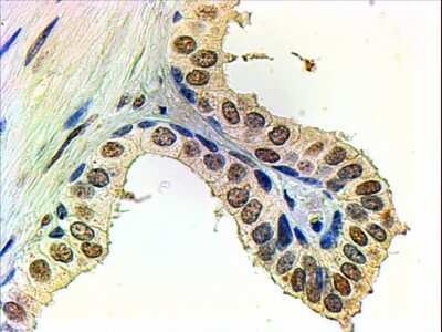 Immunohistochemistry-Paraffin: Androgen R/NR3C4 Antibody [NB100-1446]