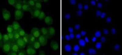 Immunocytochemistry/ Immunofluorescence: Androgen R/NR3C4 Antibody (ST0453) [NBP2-67497]