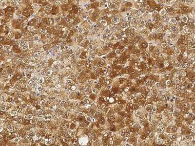 Immunohistochemistry-Paraffin: Angiogenin Antibody [NBP2-98773]