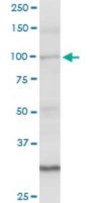 Western Blot: Angiomotin like 1 Antibody [H00154810-D01P]