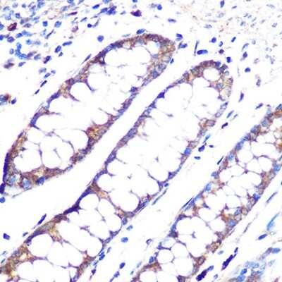 Immunohistochemistry-Paraffin: Angiopoietin-1 Antibody (6C4S7) [NBP3-16269]