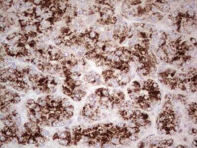 Immunohistochemistry: Angiopoietin-1 Antibody (OTI8H2) [NBP2-46519]