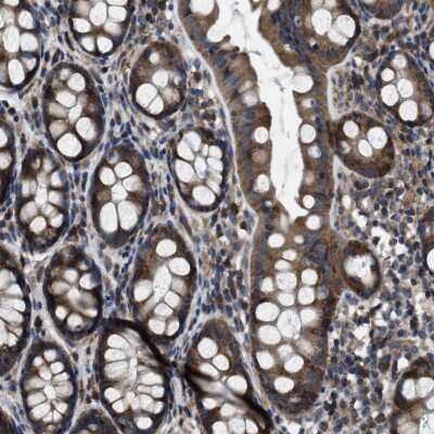 Immunohistochemistry-Paraffin: Angiopoietin-1 Antibody [NBP1-90169]