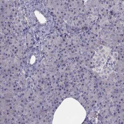 Immunohistochemistry-Paraffin: Angiopoietin-1 Antibody [NBP1-90170]