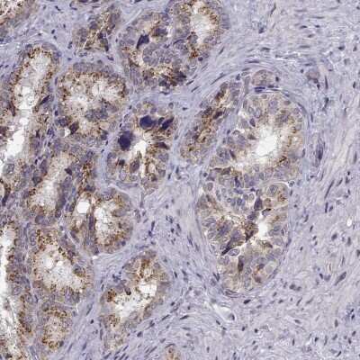 Immunohistochemistry-Paraffin: Angiopoietin-1 Antibody [NBP1-90170]