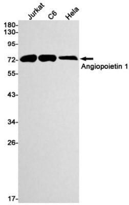 Western Blot: Angiopoietin-1 Antibody (S06-1F9) [NBP3-19492]
