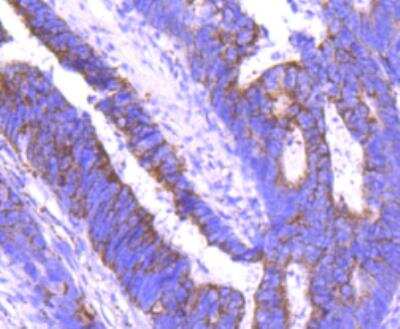 Immunohistochemistry-Paraffin: Angiopoietin-2 Antibody (JM71-34) [NBP2-67154]