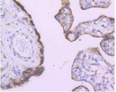 Immunohistochemistry-Paraffin: Angiopoietin-2 Antibody (JM71-34) [NBP2-67154]