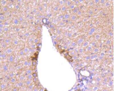 Immunohistochemistry-Paraffin: Angiopoietin-2 Antibody (JM71-34) [NBP2-67154]