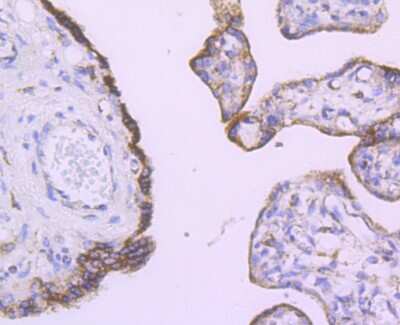 Immunohistochemistry-Paraffin: Angiopoietin-2 Antibody (JM71-34) [NBP2-67154]
