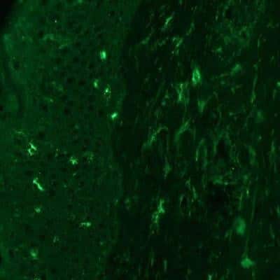 Immunocytochemistry/ Immunofluorescence: Angiopoietin-2 Antibody (MM0020-1F29) - Azide and BSA Free [NB110-85467]