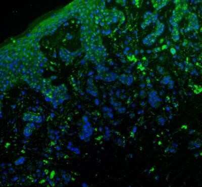 Immunohistochemistry: Angiopoietin-2 Antibody (MM0020-1F29) - Azide and BSA Free [NB110-85467]