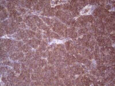 Immunohistochemistry: Angiopoietin-2 Antibody (OTI3H7) - Azide and BSA Free [NBP2-70173]