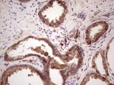 Immunohistochemistry: Angiopoietin-2 Antibody (OTI3H7) - Azide and BSA Free [NBP2-70173]