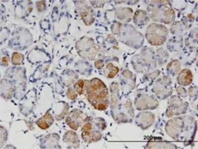 Immunohistochemistry-Paraffin: Angiopoietin-4 Antibody (1B7) [H00051378-M01]