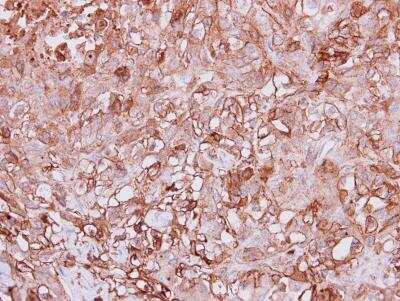 Immunohistochemistry-Paraffin: Angiopoietin-4 Antibody [NBP1-32607]