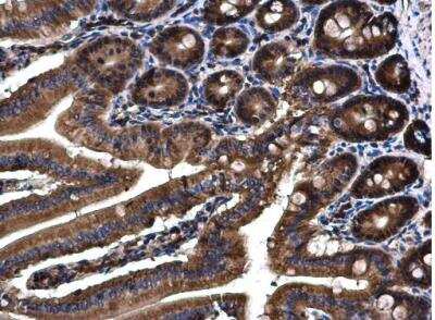 Immunohistochemistry-Paraffin: Angiopoietin-4 Antibody [NBP1-32607]