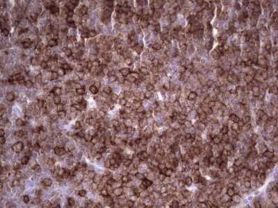 Immunohistochemistry: Angiopoietin-like Protein 1/ANGPTL1 Antibody (OTI1B2) [NBP2-46521]