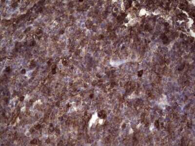 Immunohistochemistry: Angiopoietin-like Protein 1/ANGPTL1 Antibody (OTI1B2) - Azide and BSA Free [NBP2-71414]