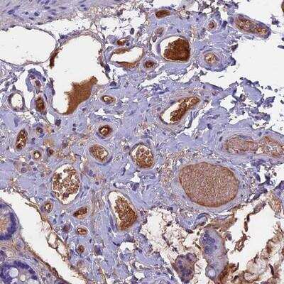 Immunohistochemistry-Paraffin: Angiopoietin-like Protein 2/ANGPTL2 Antibody [NBP1-88998]