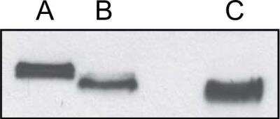 Western Blot: Angiopoietin-like Protein 2/ANGPTL2 Antibody [NBP1-79557]