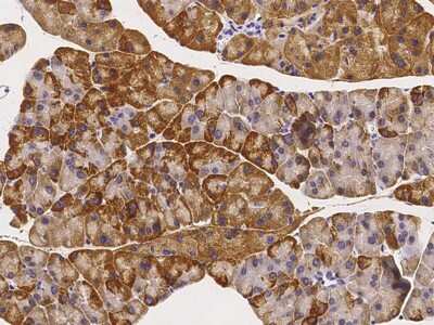 Immunohistochemistry-Paraffin: Angiopoietin-like Protein 4/ANGPTL4 Antibody [NBP2-98267]
