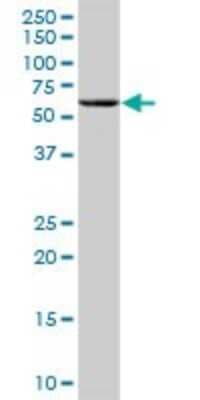 Western Blot: Angiopoietin-like Protein 4/ANGPTL4 Antibody [H00051129-B01P]