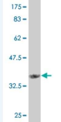 Western Blot: Angiopoietin-like Protein 7/ANGPTL7 Antibody (2C6) [H00010218-M04-100ug]
