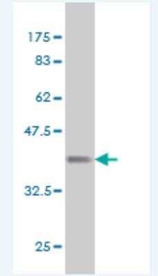 Western Blot: Angiopoietin-like Protein 7/ANGPTL7 Antibody (2C7) [H00010218-M03-100ug]