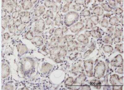 Immunohistochemistry-Paraffin: Angiopoietin-like Protein 7/ANGPTL7 Antibody (3E7) [H00010218-M02-100ug]