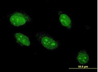 Immunocytochemistry/ Immunofluorescence: Angiopoietin-like Protein 7/ANGPTL7 Antibody (3F1) [H00010218-M05-100ug]